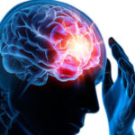 douleur à la tête et épilepsie