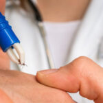 docteur pince et tiques