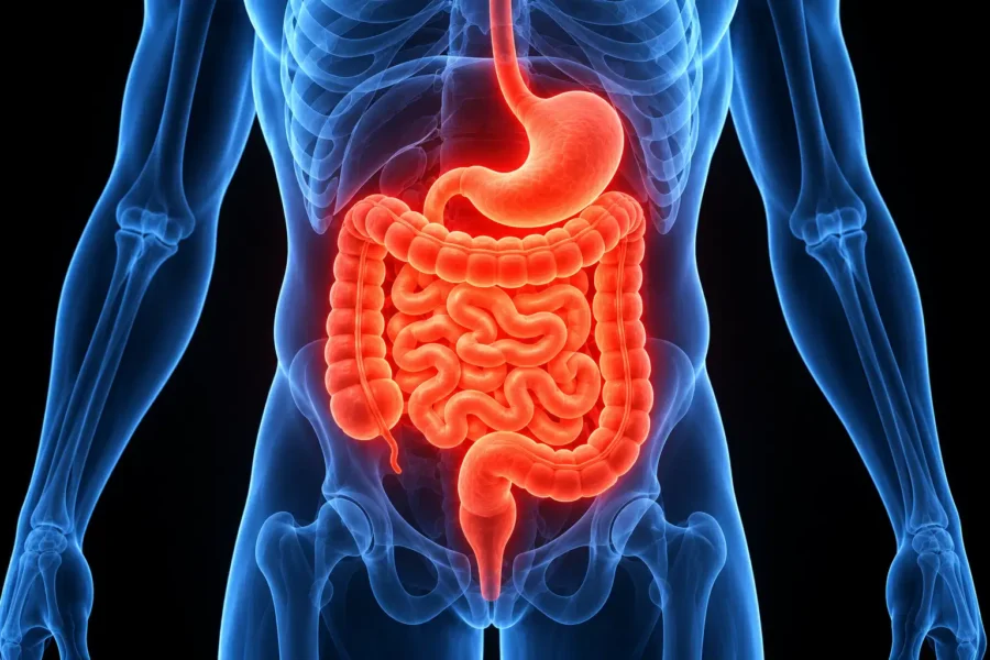 CBD és Crohn-betegség
